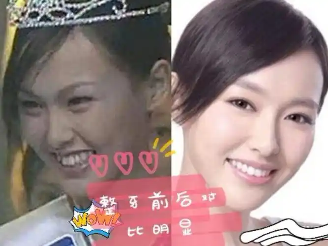 唐嫣整容先后对比明显