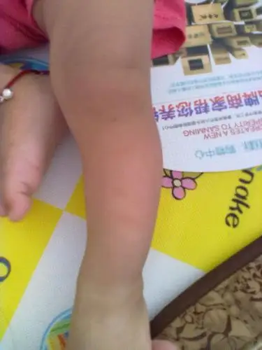 小腿弯的宝妈进来看一下 我真的好怕她是o型腿 - 2012年12月妈妈帮