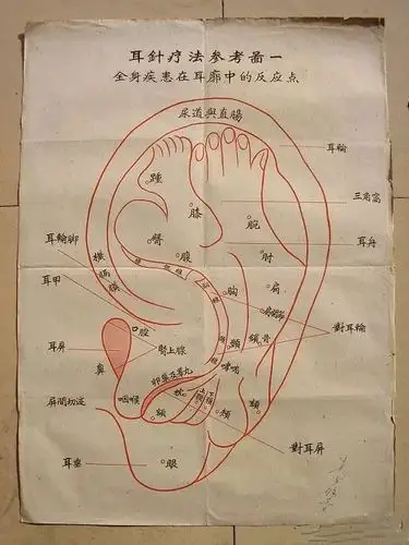 医学高级职称考试 重点总结 中医系列 中医针灸 正文使用耳针进行针灸