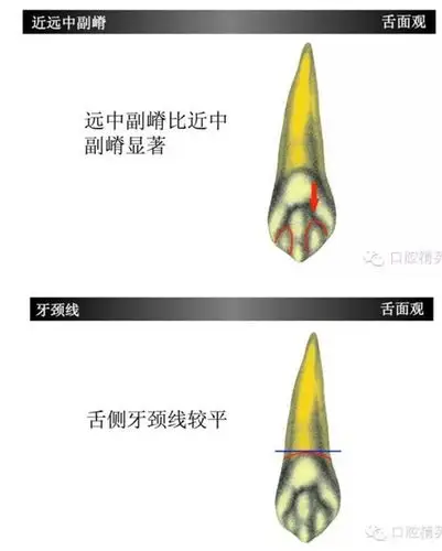 上颌尖牙(上3)如此复杂?学习了