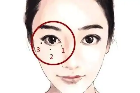 破财痣破财痣长在哪里