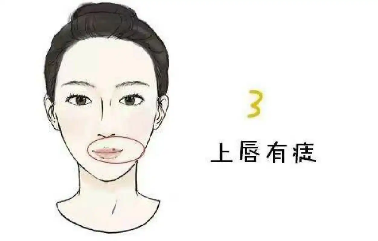 嘴唇痣其实也是桃花痣的一种 若上嘴唇有痣的女人,个人感情方面丰富