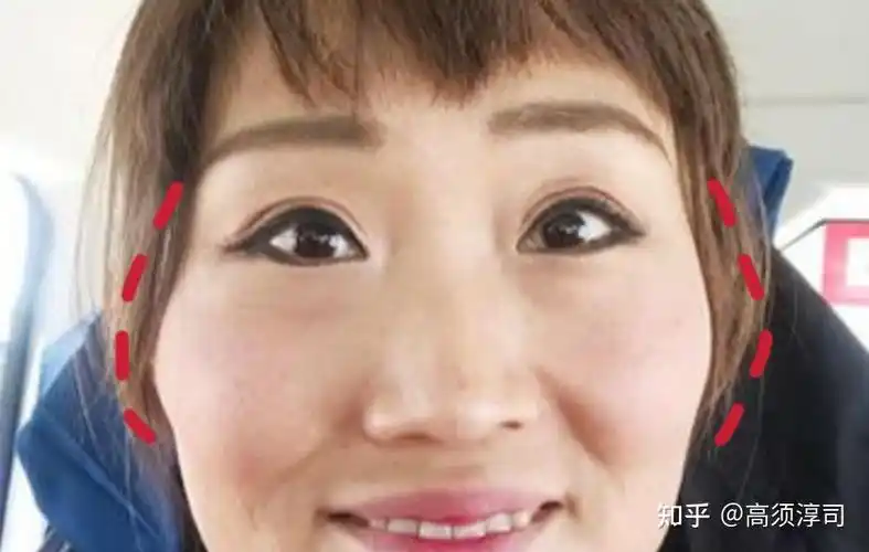 怎样分辨颧弓高还是颧骨高? - 知乎