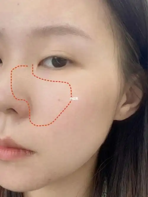 希望所有毛孔被油脂堵塞粗大的姐妹看过来