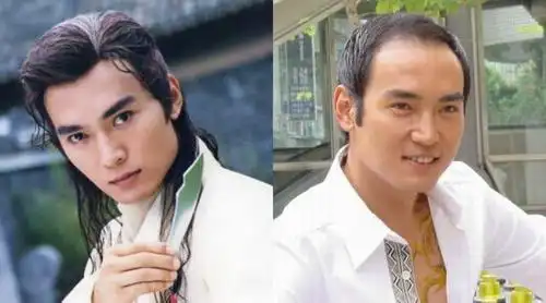 帅气也挡不住脱发的10位男明星!你知道还有谁?