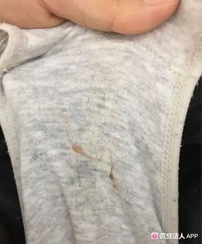 排卵期白带带粉色血丝是怎麼回事?