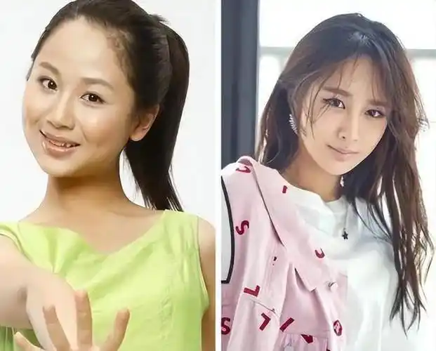 杨紫遭质疑美容整形,庆生照大幅改变,面颊绯红,脸部肿胀显僵