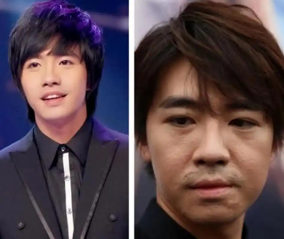 况且自己的烧伤程度高达54%,比俞灏明还要严重,理应优先使用担架,并不