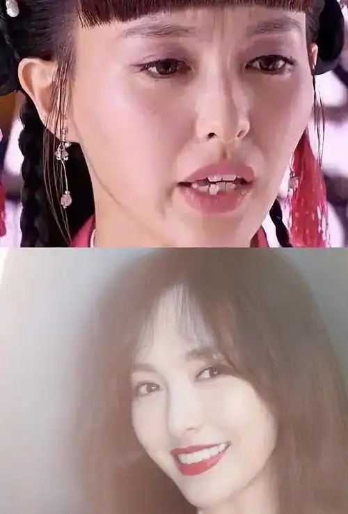明星整牙前后的对比堪比整容