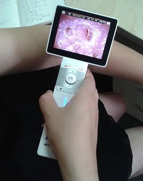 便携式电子五官镜便携皮肤镜和一般镜头自带usb输出接口