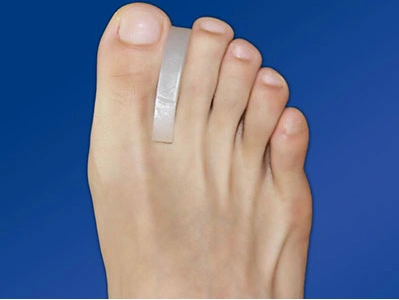 手指大拇指外翻图片