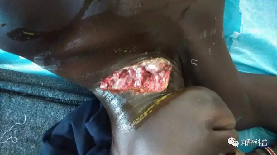 麻醉科的"爱国主义再教育"