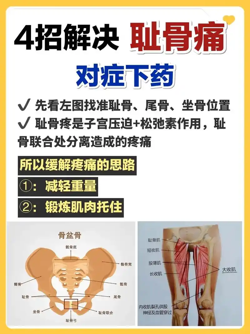 4招告别耻骨疼97从备孕到生完都要看.#怀孕 #孕期 #备孕 - 抖音
