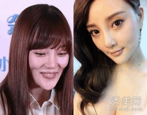 明星整容前后对比照 赵丽颖郑爽变化大