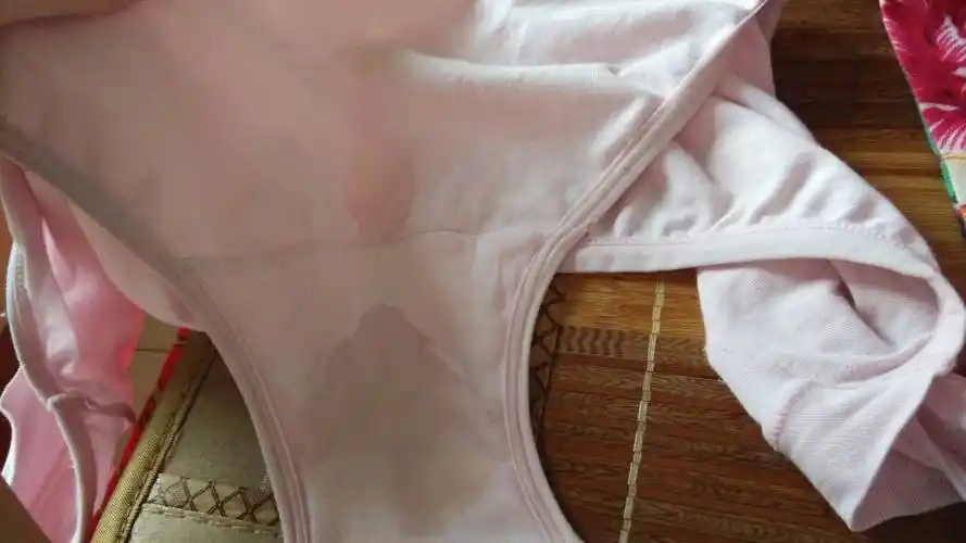 最近几天都这样,内裤湿湿的,是分泌物还是少量破水?一次就有那么多!