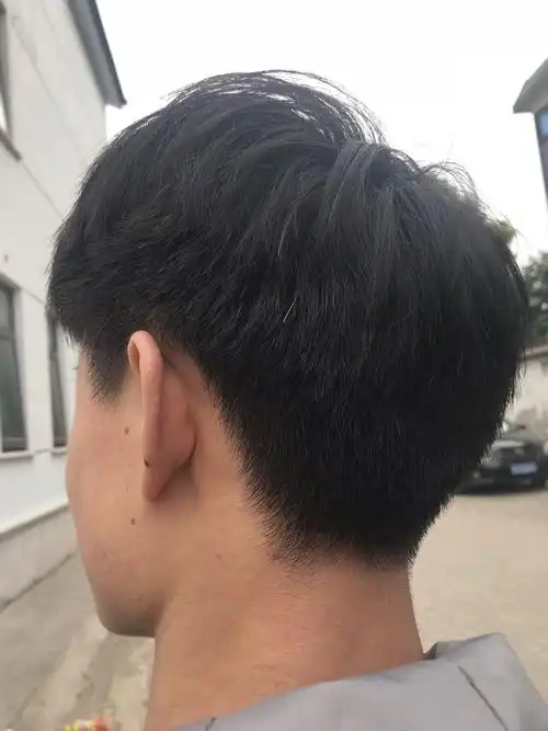 后面长了好多白头发 一两年了 不是遗传 因为什么?