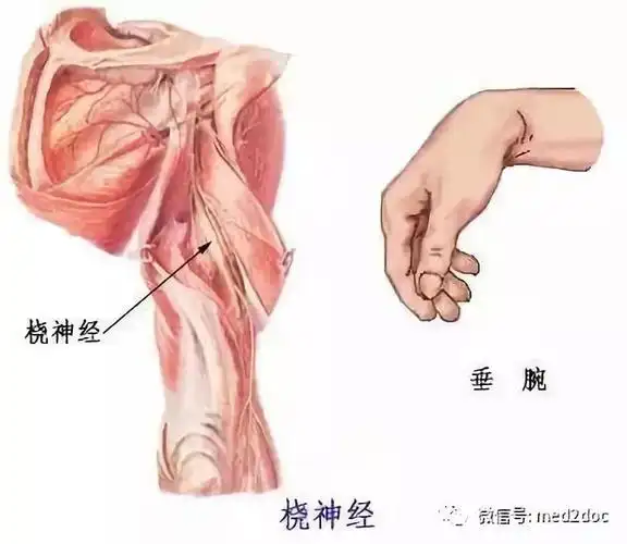 蜜月期当心"手不举"!