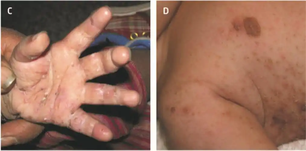 2岁以上儿童及成人;b.