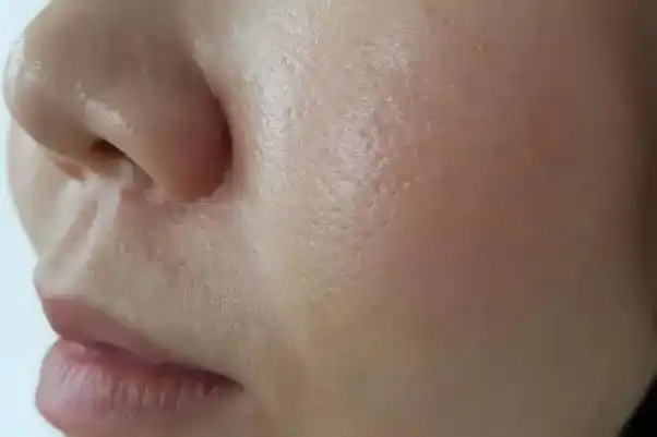 皮肤出油的表现皮肤出油的好处