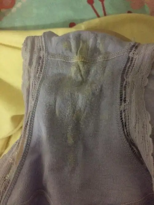 自从怀孕内裤一天一换还是这么脏,有时候还会淌水,不过不多,属于正常