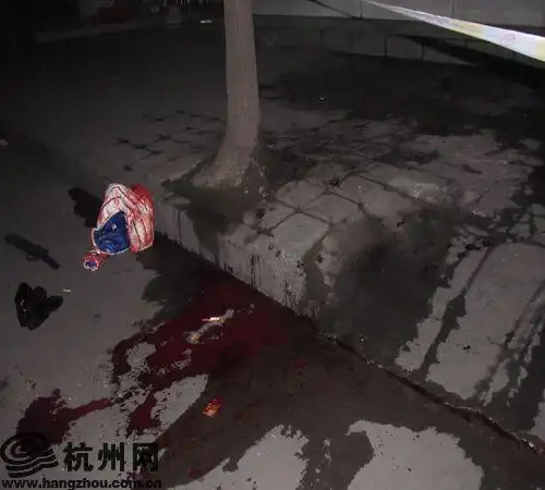 杭州"宝马女"深夜遭刀砍 曾大骂男人都是骗子