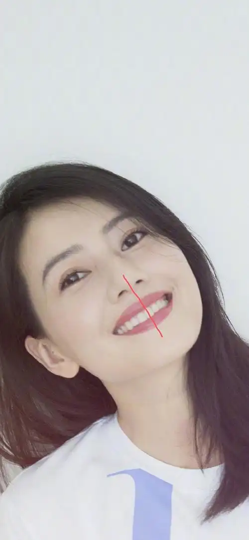 有没有人觉得高圆圆牙中线是歪的