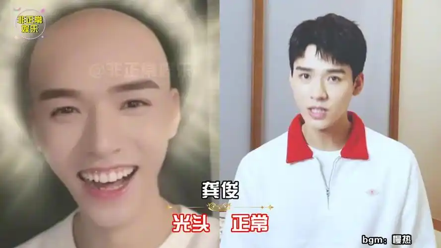 蔡徐坤:我光头高冷,李现:我光头痞帅,看到肖战:我心动了!