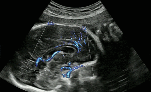 丑哭亲妈!为啥四维彩超拍出来的孩子这么丑?