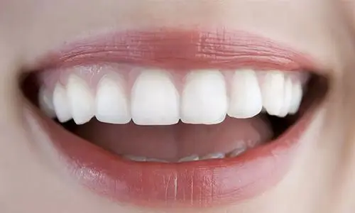 牙齿矫正前的这些注意事项一定要记得!会影响矫正效果!