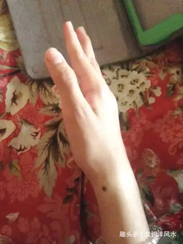 手腕生黑痣手腕生黑痣的女人脑子特别的好用,是男人身旁的智多星,做事