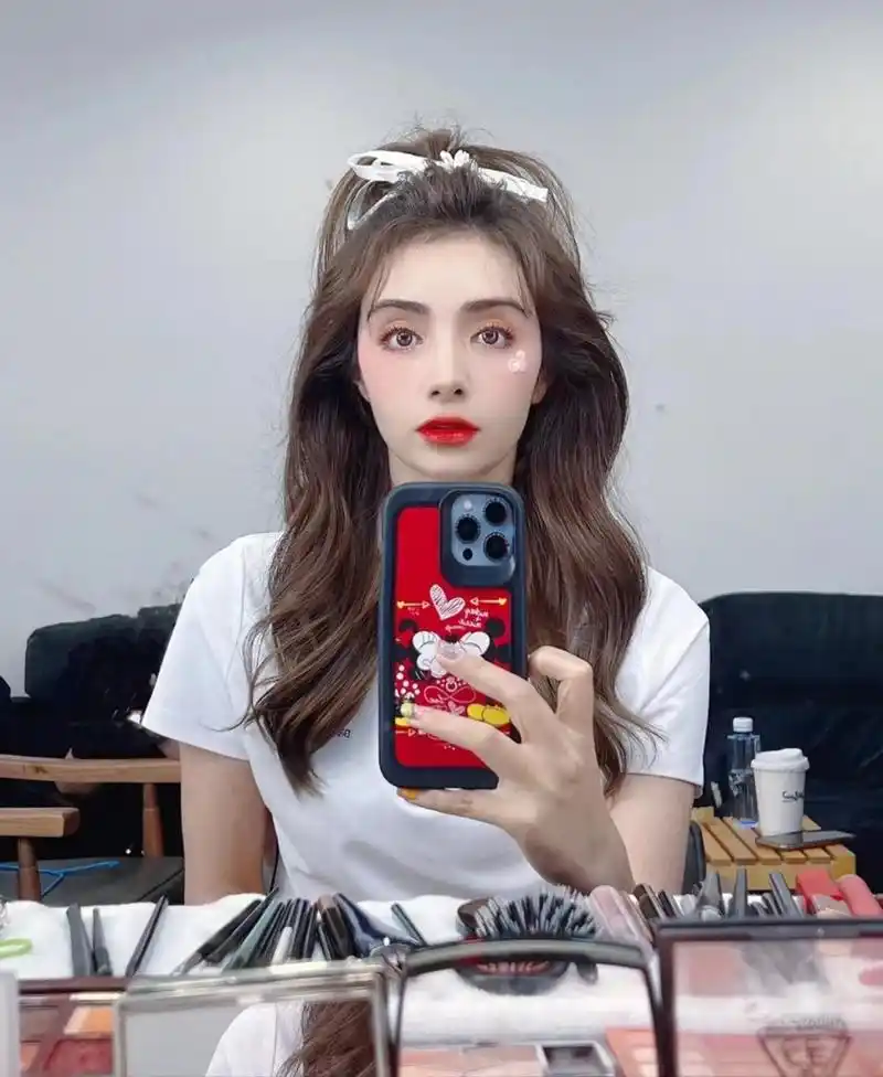 辣妈麦迪娜晒性感美照穿短裙后背火罐印明显一双美腿又长又白