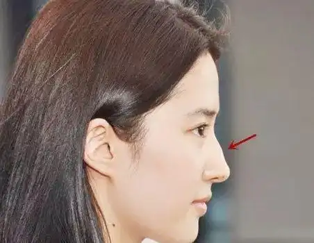 刘亦菲驼峰鼻面相(驼峰鼻型的女人面相)