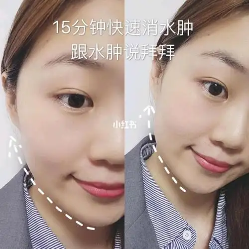 改善大饼脸摆脱水肿7070