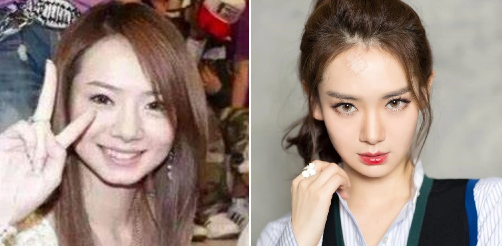 其实单看戚薇的五官,以前和现在并没有什么太大的变化.