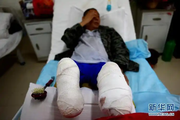 安徽自锯病脚男子已接受截肢手术 目前恢复状况良好_新闻频道