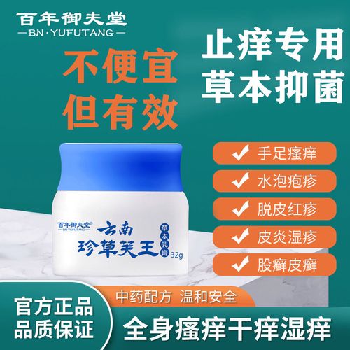 湿疹皮肤瘙痒手脚神经性皮炎顽固性皮炎牛皮癣鲜特效止痒乳膏正品