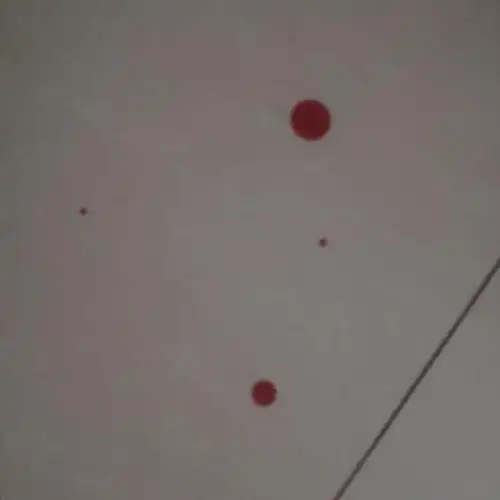 切芒果不小心切到手,血滴到地上,包扎好后感觉好像兔子.