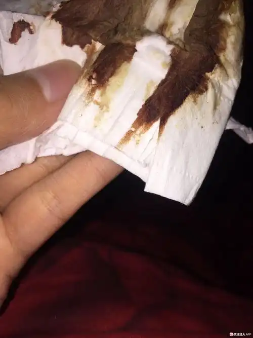 我做一超的时候医生说子宫有积血