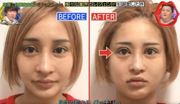 从石原里美到广濑丝丝这位日本整容明星到底想把自己变成谁