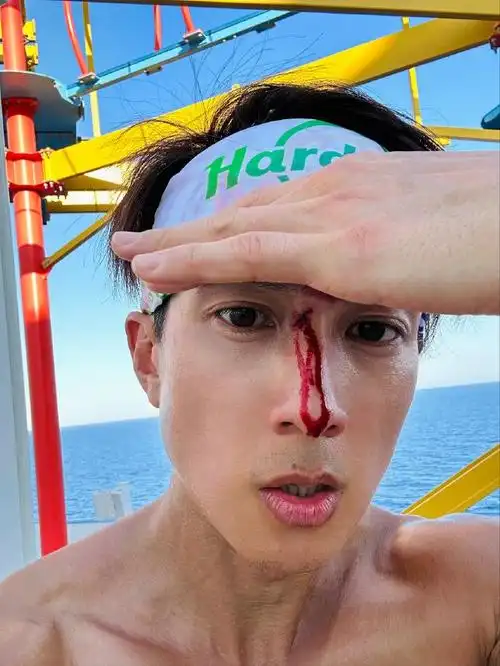 吴尊篮球场上意外鼻梁受伤伤口血流不止淡定自拍求助网友