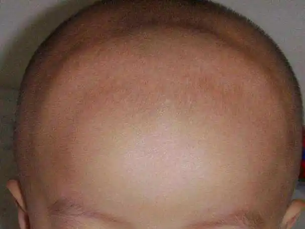 卤门闭合和婴儿健康息息相关,五种情况,第三种有点吓人