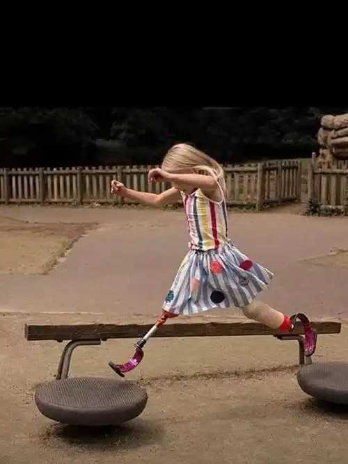 双腿截肢的9岁小模特登上了纽约时装周