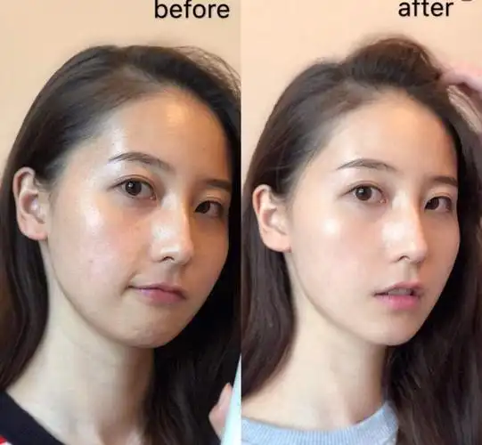 春季皮肤问题烦不烦皮肤暗黄早改善调整作息正确滋补是诀窍