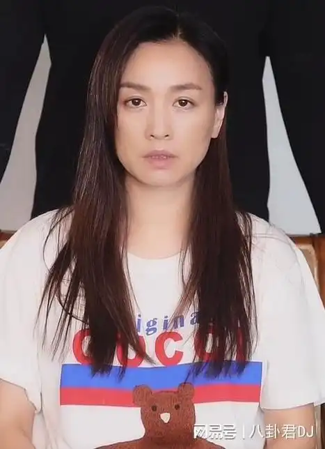 照片中张庭身穿一件白t恤,头发看起来似乎是有点枯燥,双眼无神,眼里