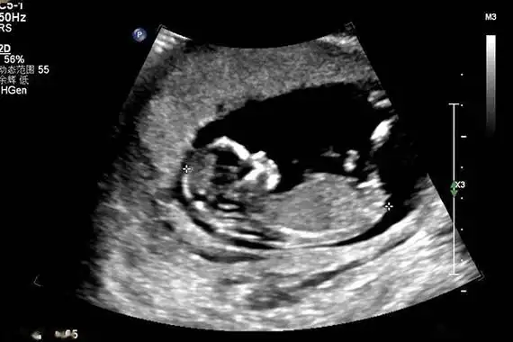 nt单子女孩图片