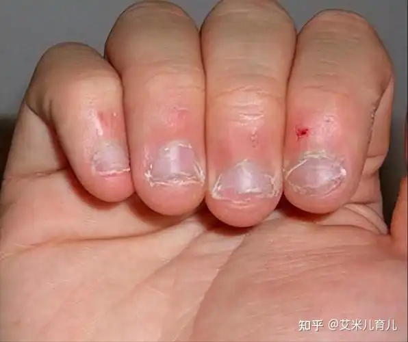 记得我家大宝从出生不久,就喜欢把手指头放到嘴巴里吃,并且吃得津津有