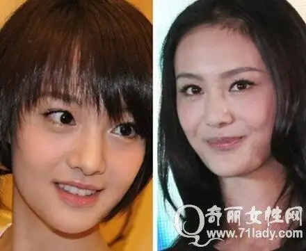 郑爽整容后男友张翰惊呆 整容前后差别巨大昔日清纯形象不再