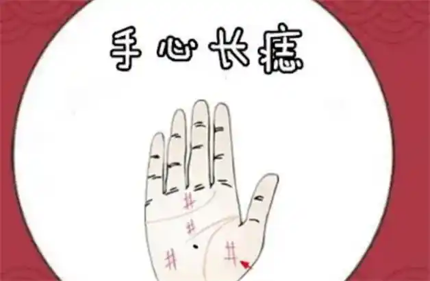 手心有痣代表什么