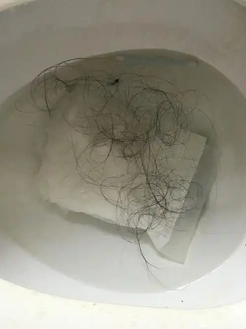 十一岁女孩梳头掉头发掉这么多,睡觉不掉一梳头就掉,头发为披肩长度