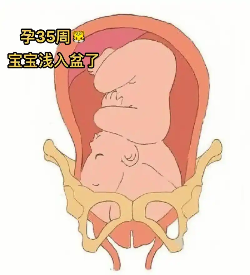 孕35周宝宝就已经浅入盆了.你们都是多少周入盆的?  入盆之 - 抖音